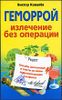 Геморрой. Излечение без операции